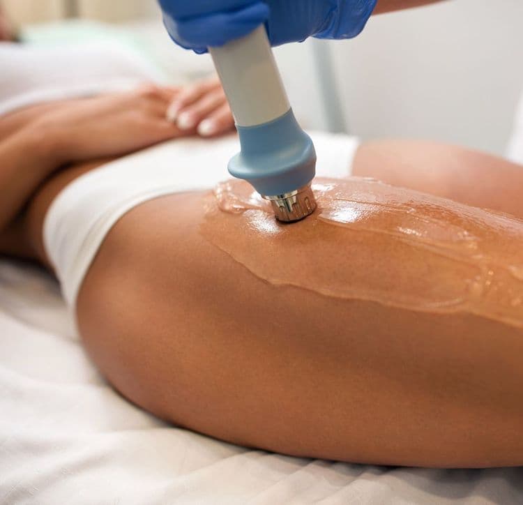 Przebieg zabiegu fali uderzeniowej antycellulitowej