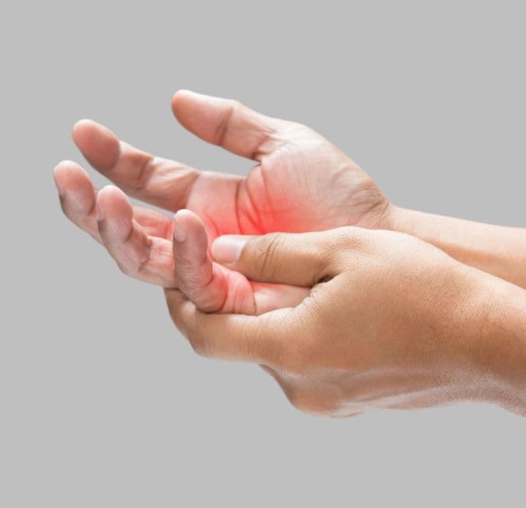 Zbliżenie na dłonie, z których jedna podtrzymuje drugą, z zaznaczonym czerwonym polem na wnętrzu dłoni, co symbolizuje parestezje, drętwienie lub ból neuropatyczny.