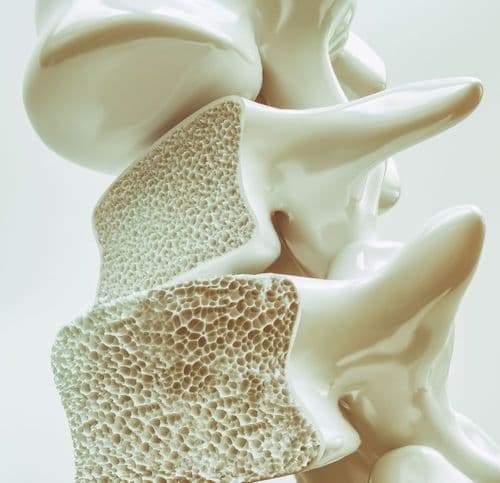 Trójwymiarowy model kręgów kręgosłupa z widoczną porowatą strukturą kostną, charakterystyczną dla osteoporozy..