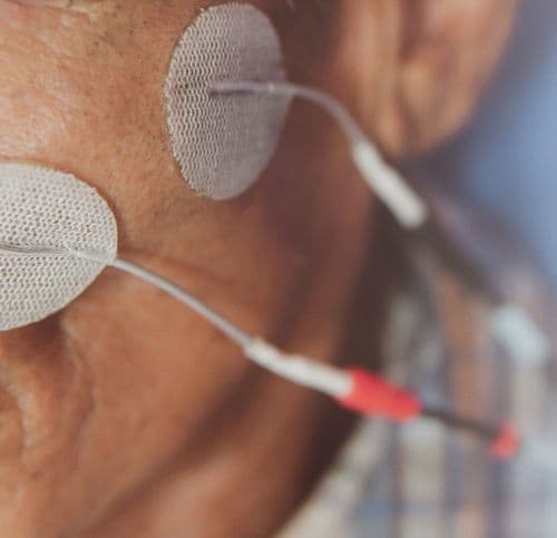 Zbliżenie na twarz pacjenta z naklejonymi elektrodami rehabilitacyjnymi w okolicach oczu i policzka.